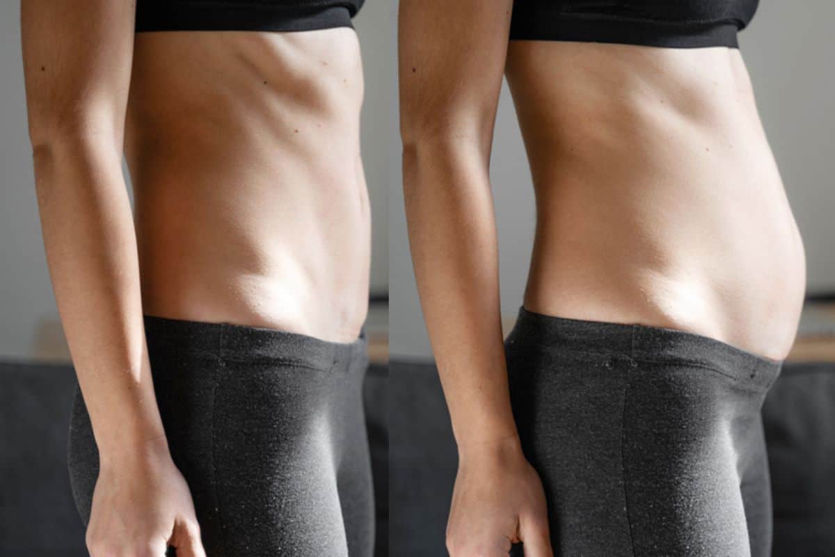 How long does diastasis recti take to improve Woodford?