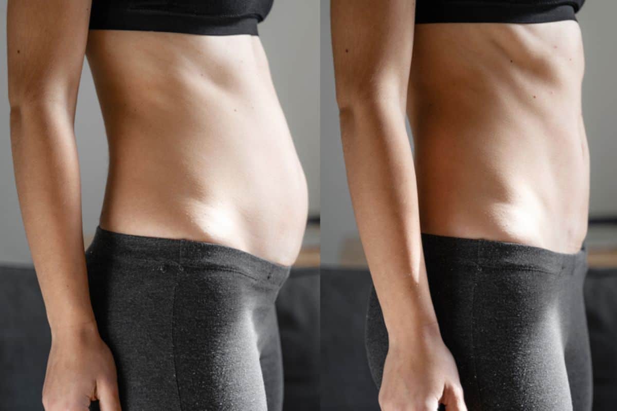 Post-Pregnancy: What Happens to Your Abdominal Muscles After Birth Woodford