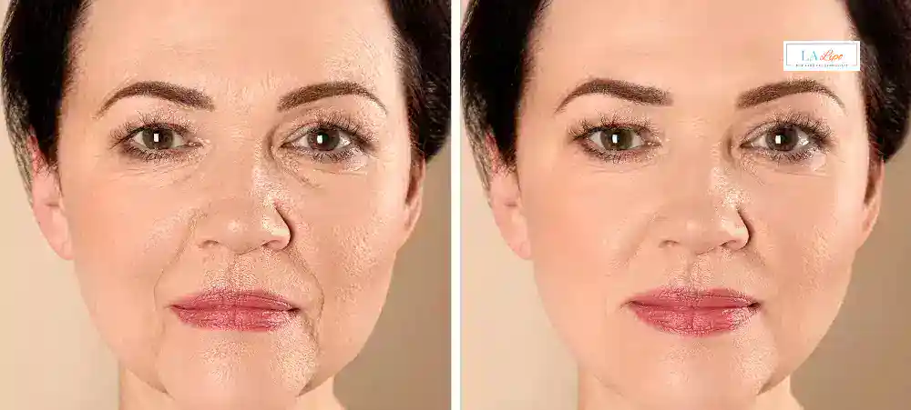 Why Aren’t My Skincare Products Making My Sagging Skin Look Firmer Woodford?