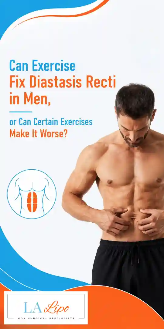 Can Exercise Fix Diastasis Recti in Men, or Can Certain Exercises Make It Worse Woodford?