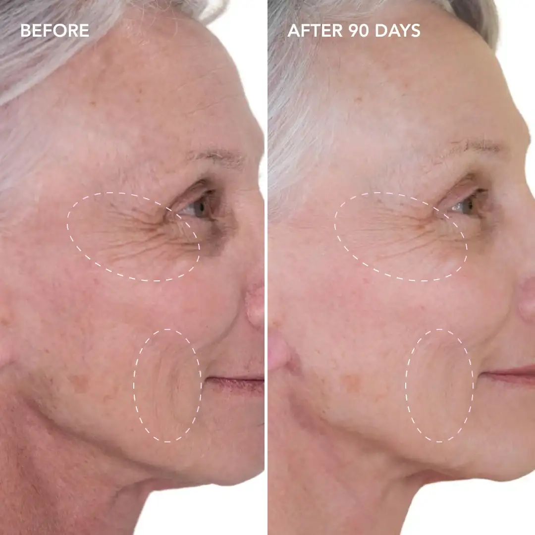 When will you see results Woodford